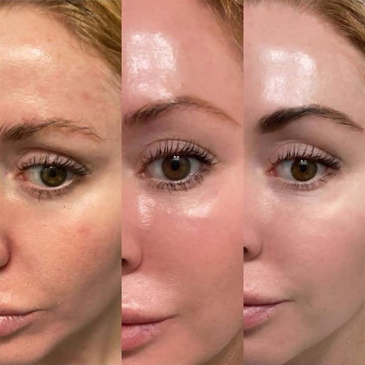 Beauty Treatment